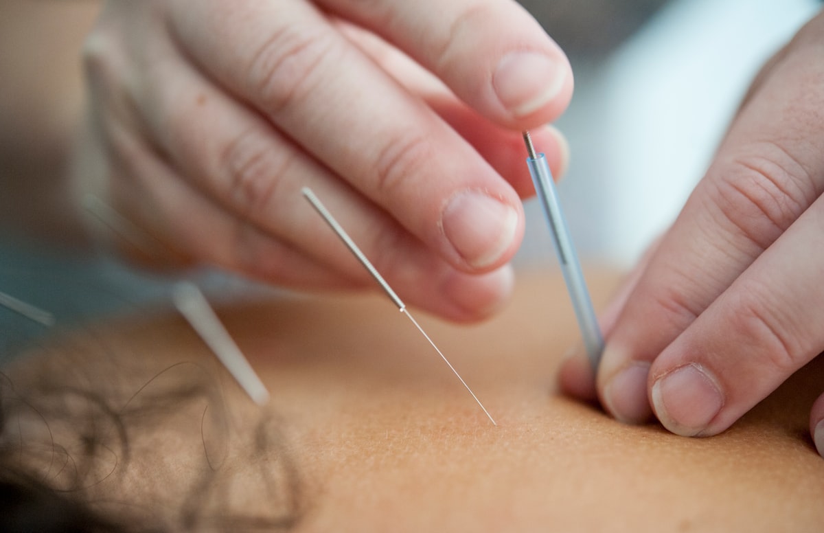 Ayurveda - Traditional Indian wellness system